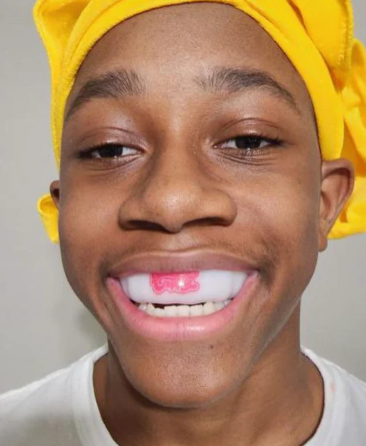 Bitches be Trippin Mouthguard - Image 2